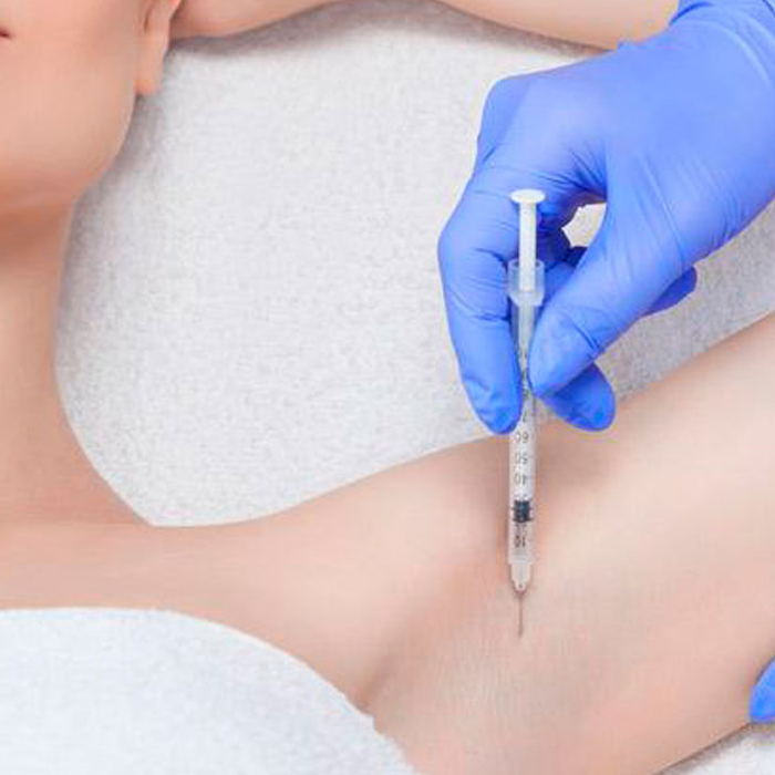 700_botoxhiperdrosis